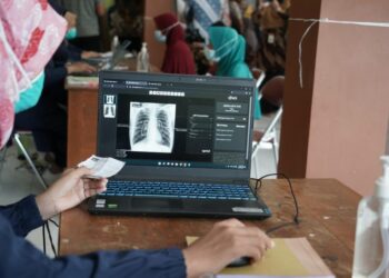 Kemenkes: Kenali Kelompok yang Berisiko Tinggi Tertular TBC